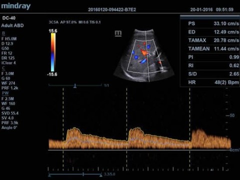 Аппарат ультразвуковой диагностический DC-40 - 388 500 руб.