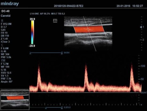 Аппарат ультразвуковой диагностический DC-40 - 388 500 руб.