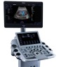 УЗИ аппарат Edan Acclarix LX25 - 958 936 руб.