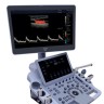 УЗИ аппарат Edan Acclarix LX9 - 2 256 320 руб.