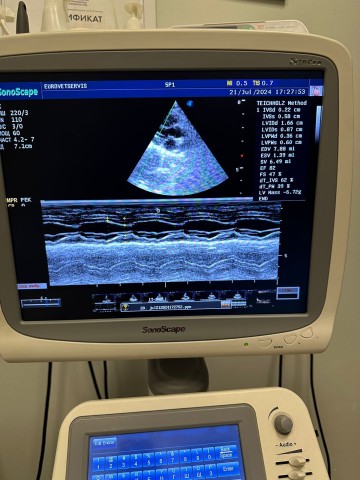 УЗИ аппарат Sonoscape S20 Pro, 2017 г.в. - 700 700 руб.