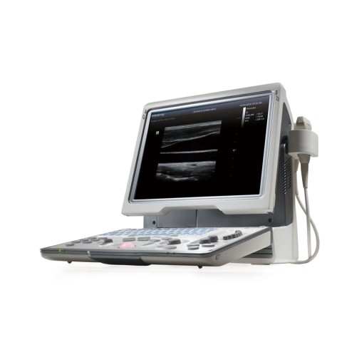 УЗИ аппарат Mindray DP-50 Color - 345 700 руб.